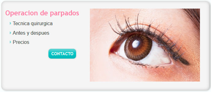 operacion de parpados precios, operacion de parpados inferiores, operacion de bolsas de ojos precios argentinos, operacion de bolsas de ojos antes y despues,