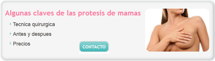 cirugia de mamas precios argentina 2014, aumento de mamas, cirugia de lolas, implantes de mamas, cirugía de mamas, protesis de mamas, aumento de mamas+costo argentina, pexia definicion
