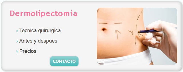 dermolipectomia, minidermolipectomia imagenes, cuanto cuesta una dermolipectomia en argentina, minidermolipectomia precios, precio minidermolipectomia,  